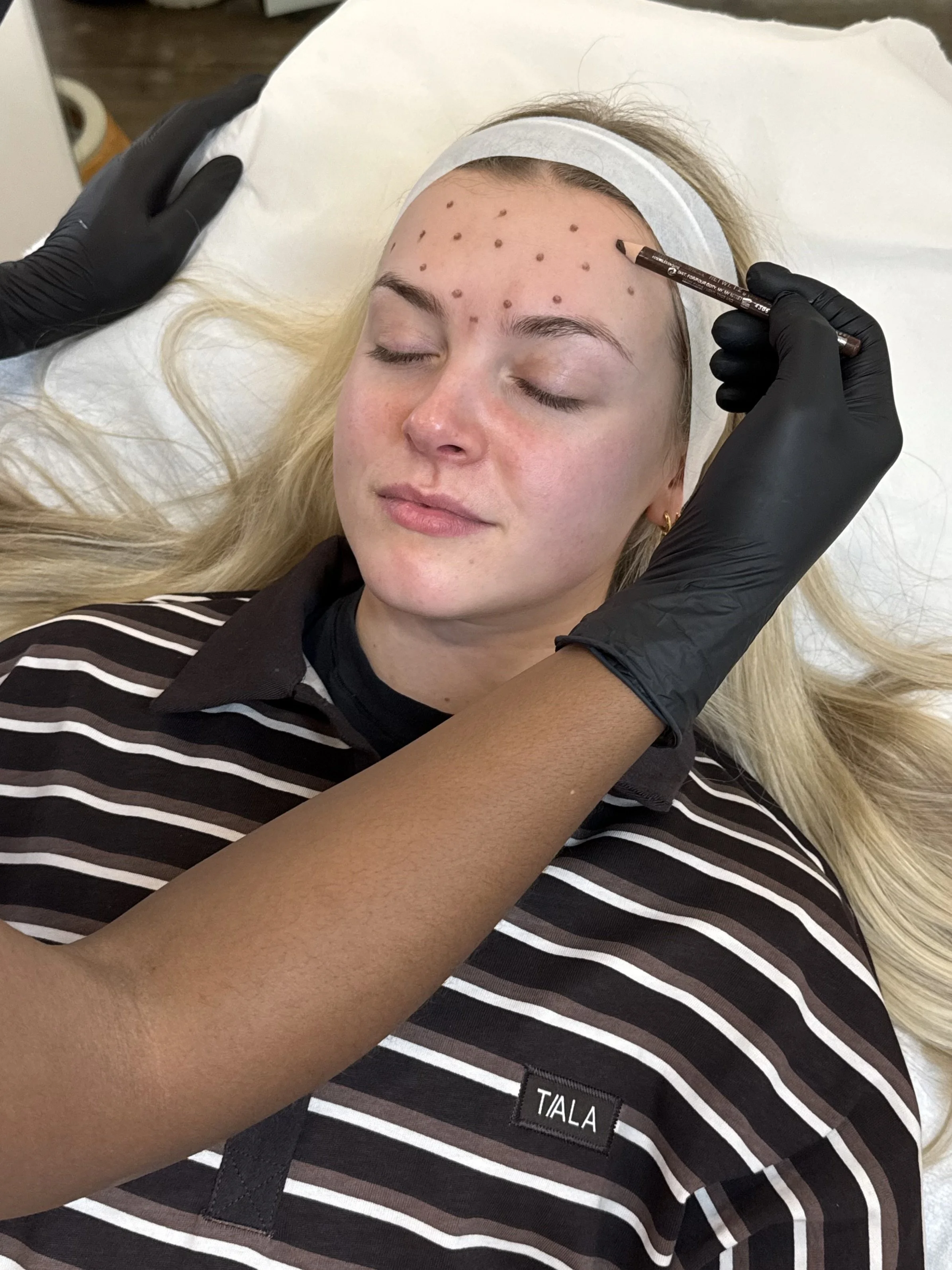 precise markings on client face prior to injectable aesthetic treatment in Ilkley