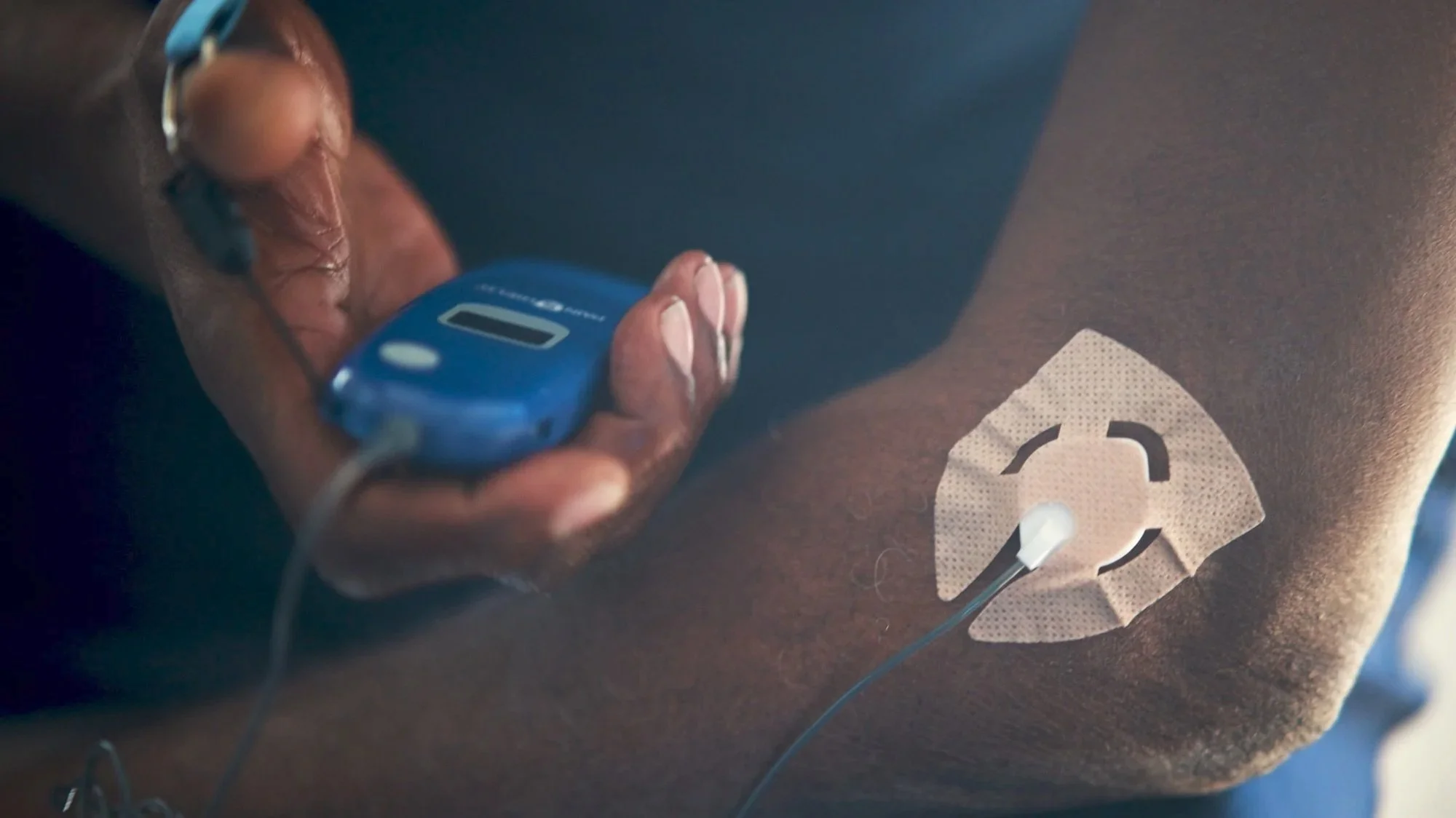 Close-up of a person's arm with a bandage and electrode patches, attached to a medical device held in their hand, during a medical procedure.
