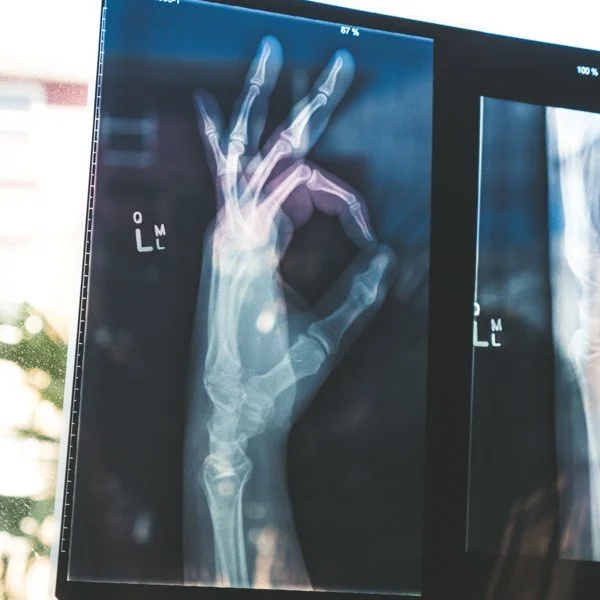 How To Keep Your Bones Healthy and Strong