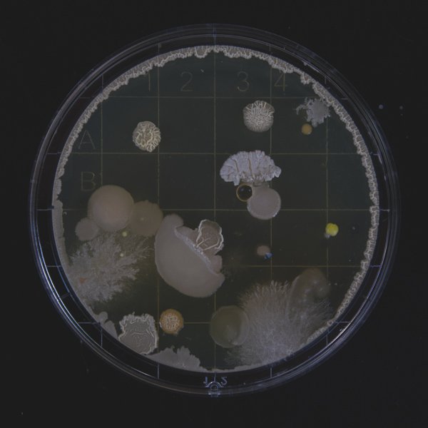 Mold: It Might Be Silently Destroying Your Health