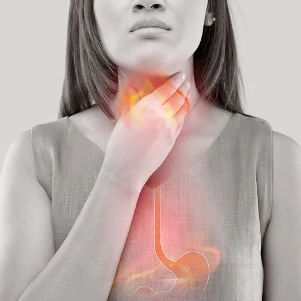The Truth About GERD: 6 Easy Steps to Reduce Acid Reflux