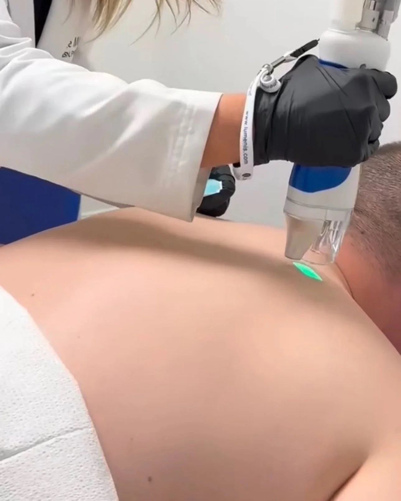 Men's Back - Laser Hair Removal