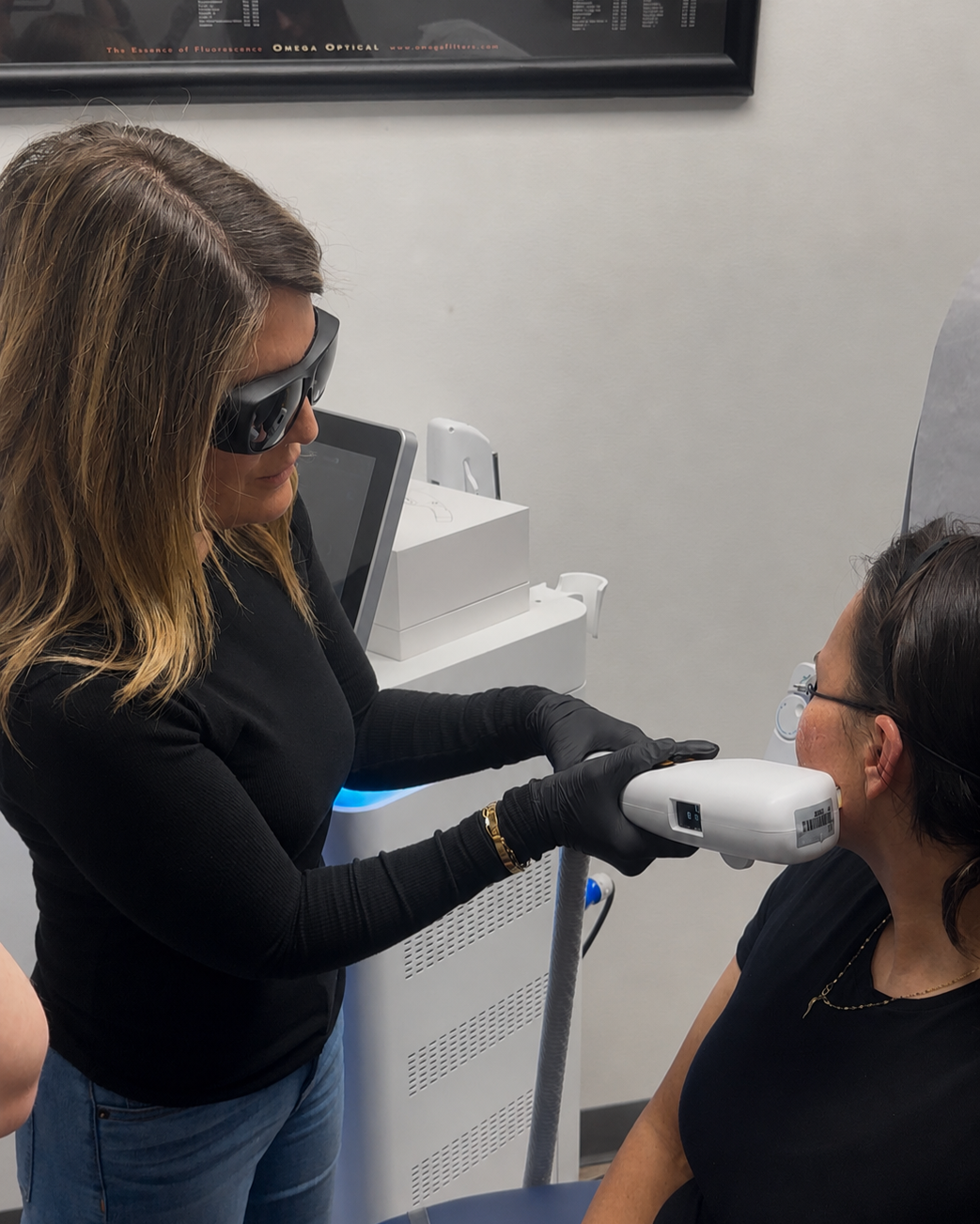IPL Treatment