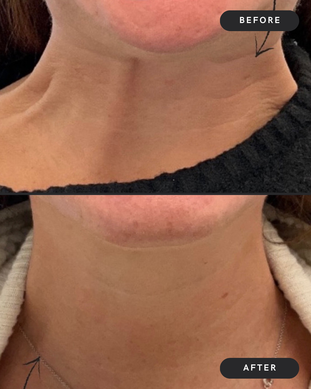 Neck Bands