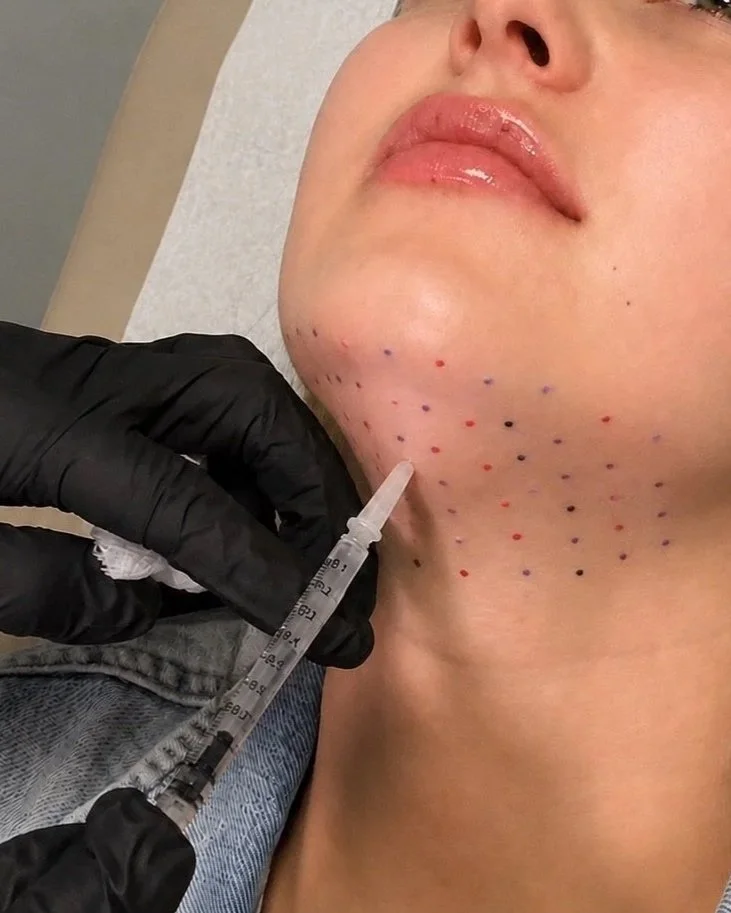 Kybella+Stock.jpg