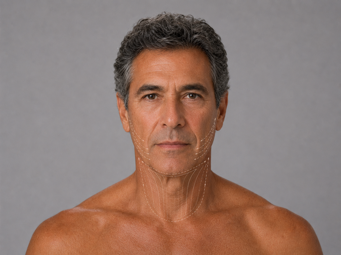 Necklift