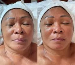 Snatch & Sculpt (Lymphatic Facial)