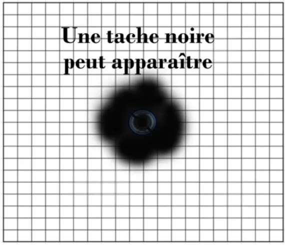 Texte en français disant 'Une tache noire peut apparaître', avec une tâche noire floue sur un fond quadrillé