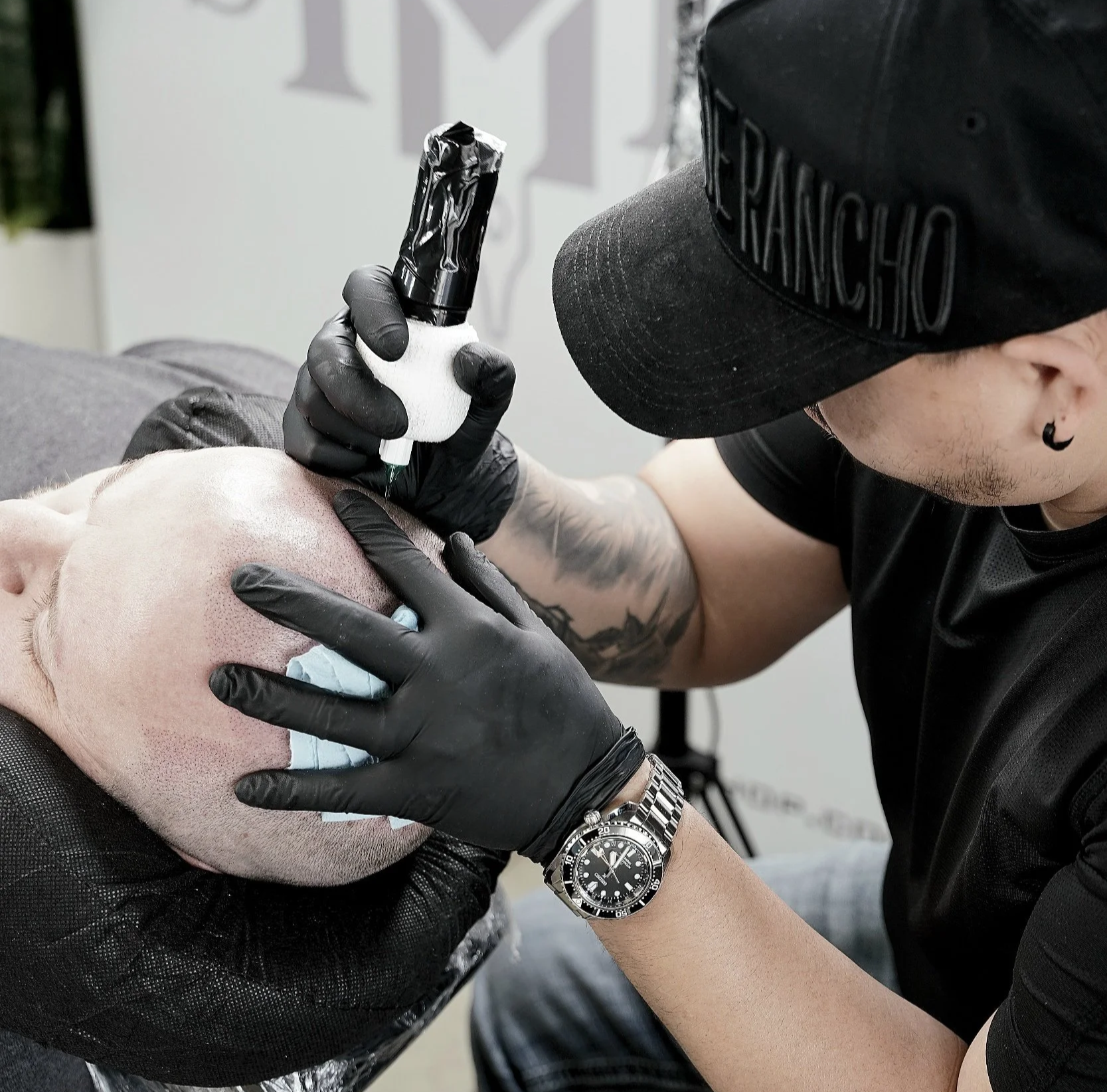 This is a picture of scalp micro pigmentation.