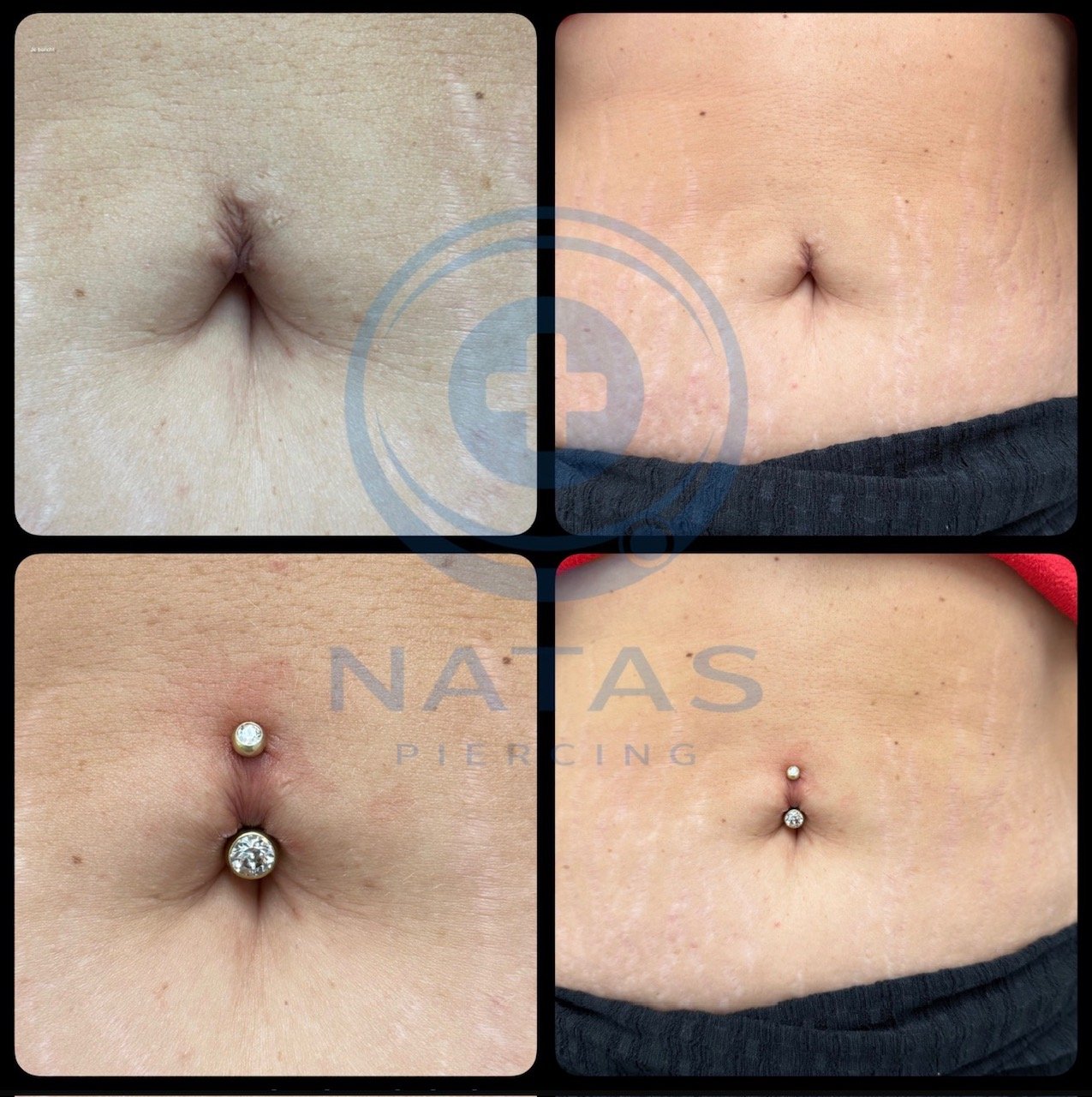 Navel piercing opnieuw na zwargerschap