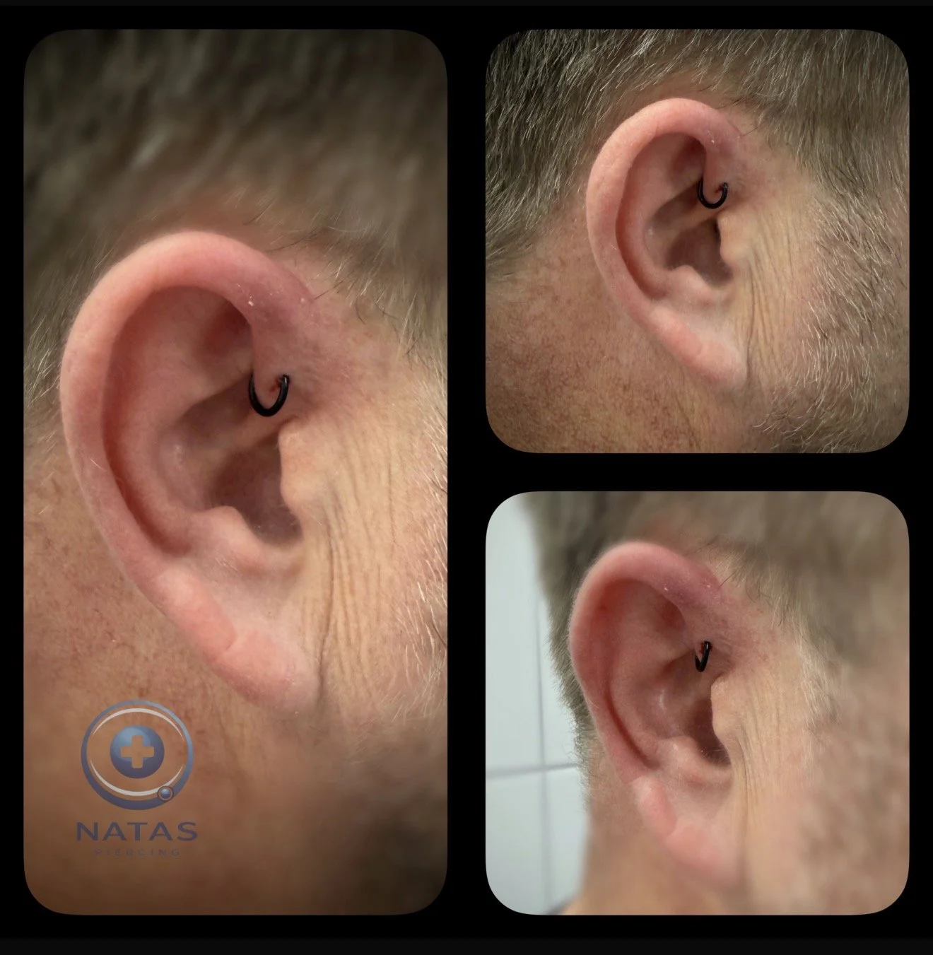 Forward Helix man