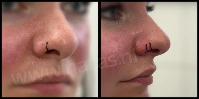 dubbeleneuspiercing.JPG