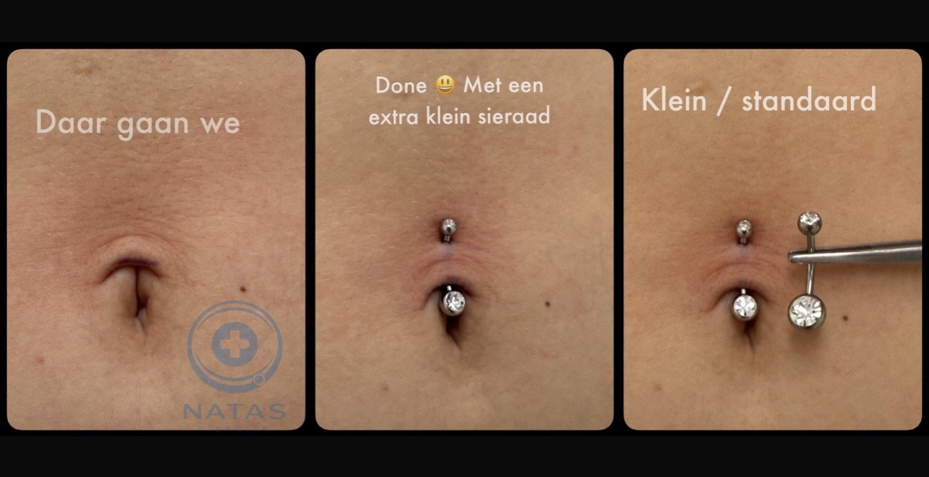 navelpiercing na zwangerschap met ringetje.JPG