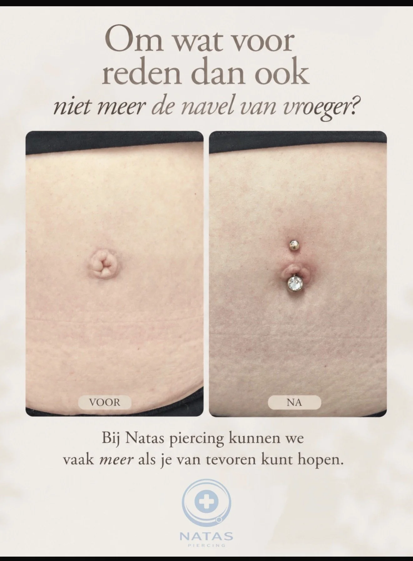 navelpiercing na operatie.JPG