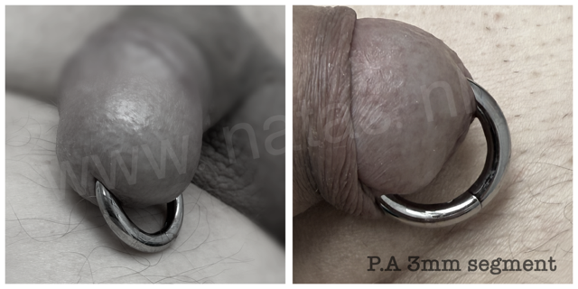 prins albert piercing.PNG