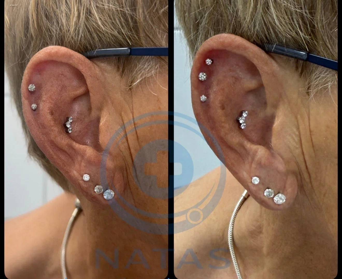 dubbele Helix piercing