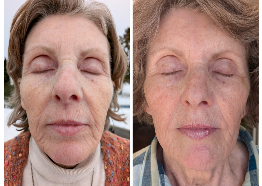 Visible improvements in skin texture following personalized nutritional support.