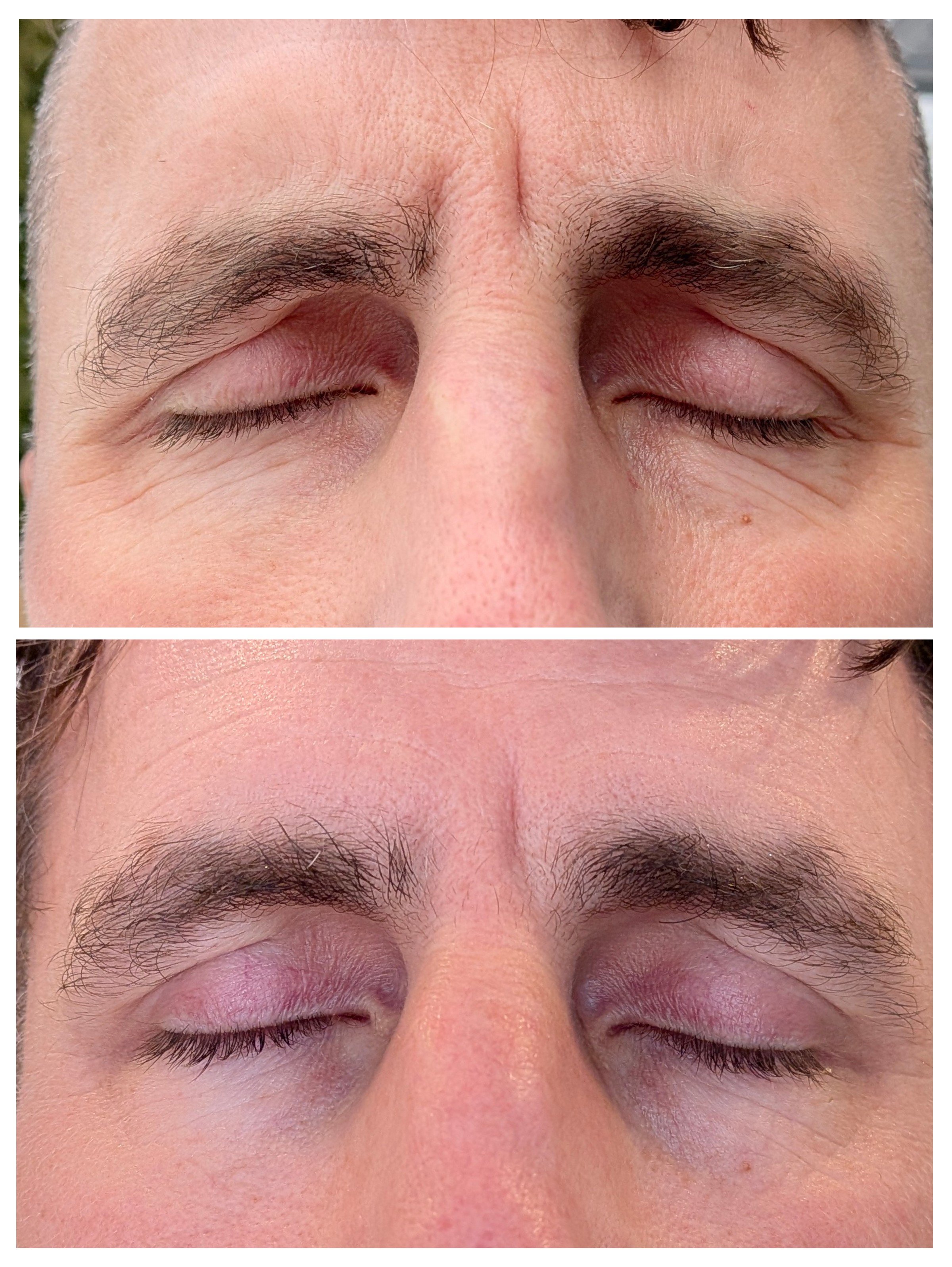 Visible improvements in skin texture following personalized nutritional support.