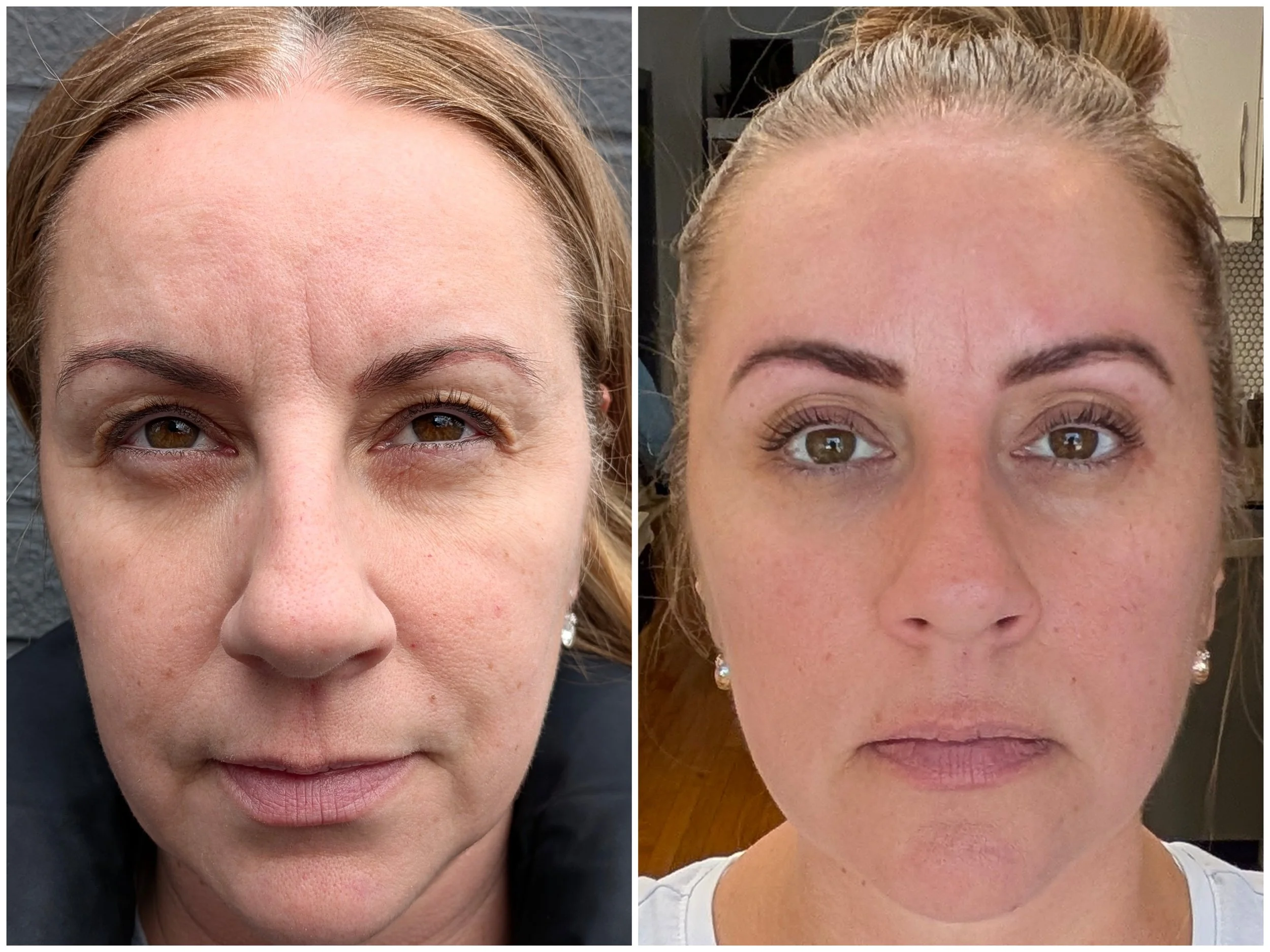 Before and after natural anti-aging results with Cellular Beauty.