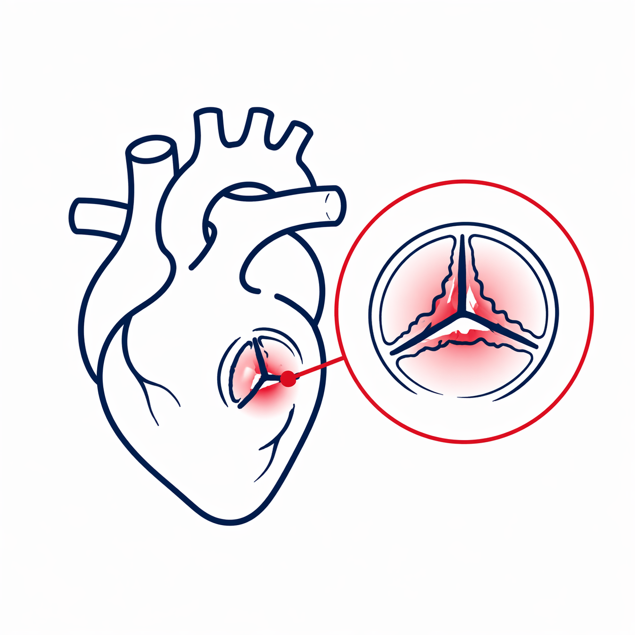 Illustration of a human heart with an inset showing a detailed view of blood flow inside a blood vessel, highlighting areas with redness.