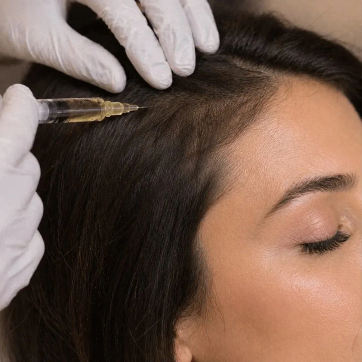 Person receiving hair treatment with a syringe, lying on her side with closed eyes, dark hair, and natural makeup.