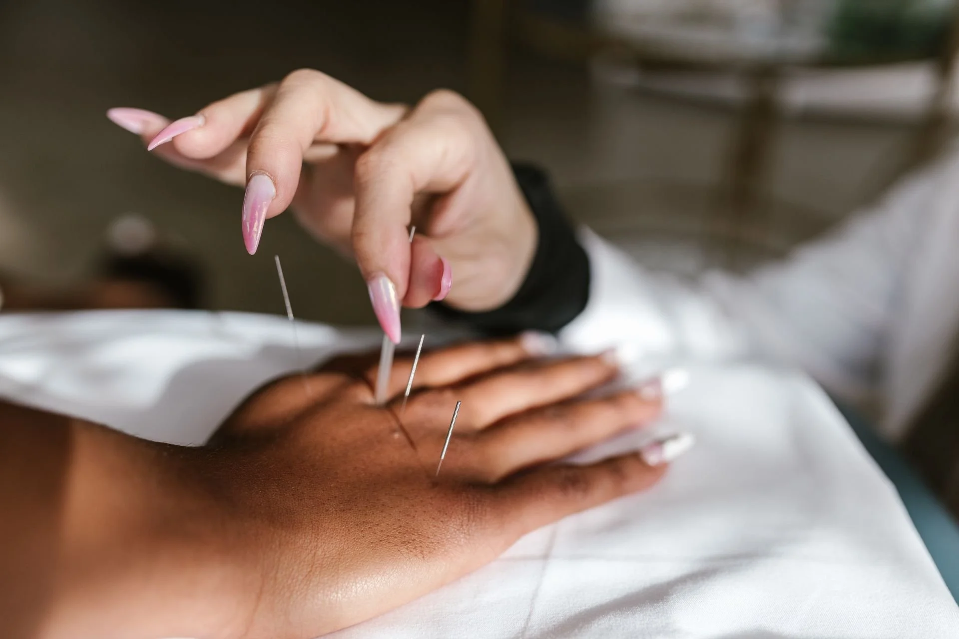 Acupuncture for IVF and IUI Support in Overland Park, KS