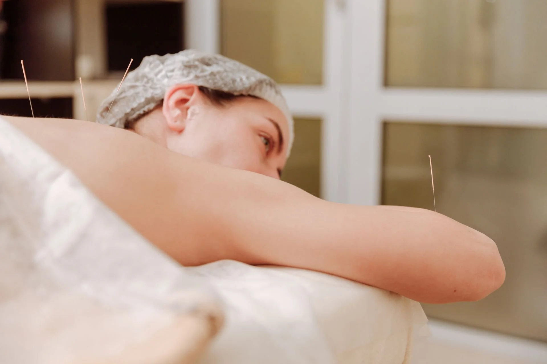 Acupuncture for Menopause Symptoms and Hot Flashes in Overland Park