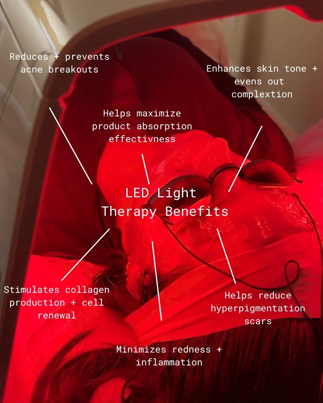 ✨ Red Light Therapy in Lake Elsinore, CA ✨

Looking for a natural way to improve your skin and boost your glow? Red Light Therapy at Bella Rejuvenation Cosmetic Center is a non-invasive treatment designed to support overall skin health and rejuvenati