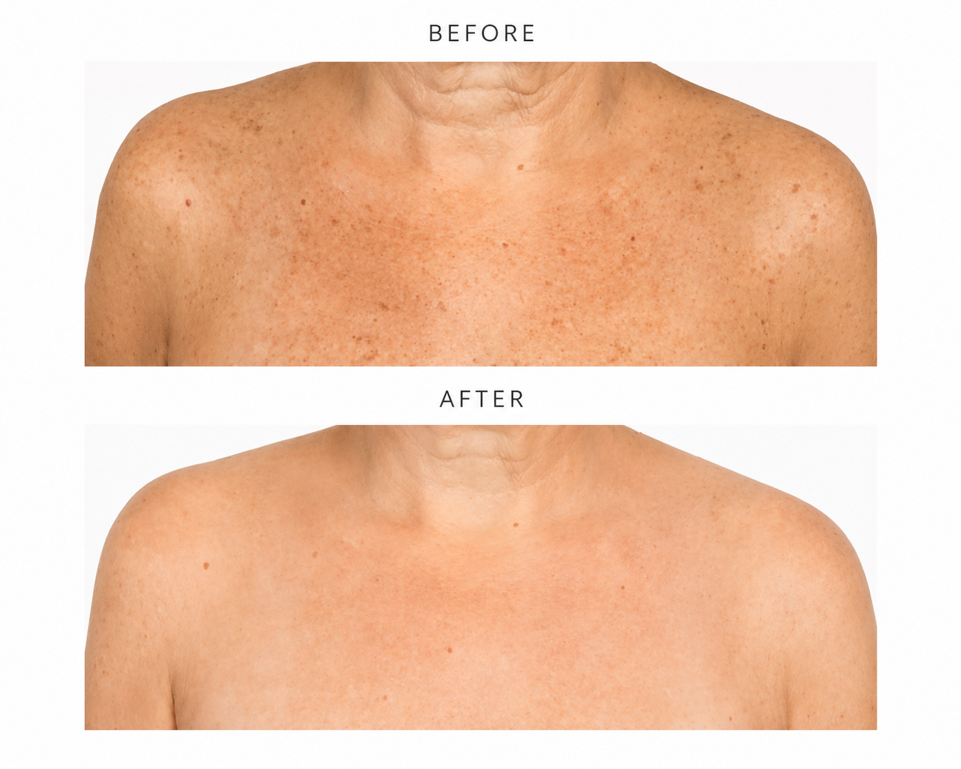 The Part of Aging Nobody Warns You About: Your Chest Gives Away Your Age First