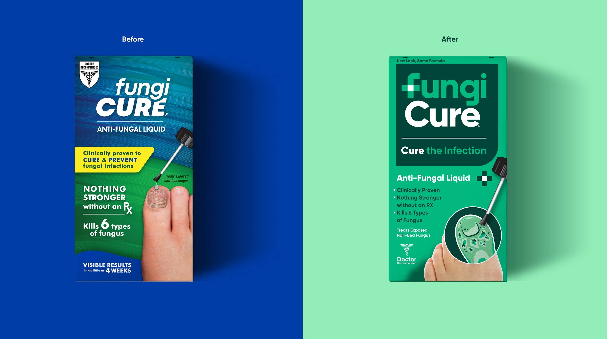 Comparison of two packaging designs for Fungicure antifungal liquid, with the left labeled 'Before' and the right labeled 'After.' The 'Before' package features a blue and green design with a finger showing a fungal nail infection, while the 'After' package has a new green design with an illustration of fungal infection in a cup.