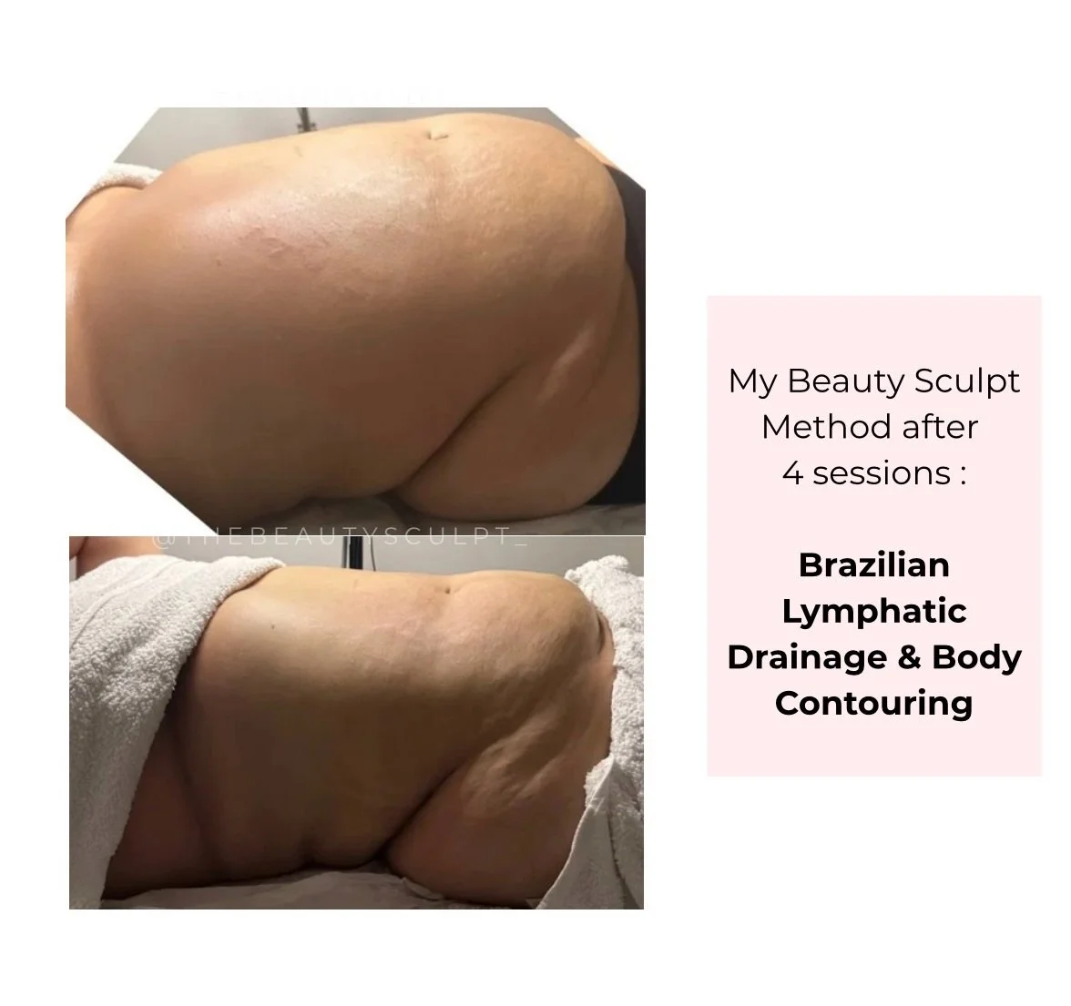 I originally wanted to wait until we completed the full 6-session protocol, but I&rsquo;m already so happy with the results we achieved in just 4 sessions.

Using my My Beauty Sculpt Method, I combine Brazilian lymphatic drainage with advanced body c