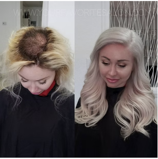 trichotillomania at salon amoura Orlando hair extensions