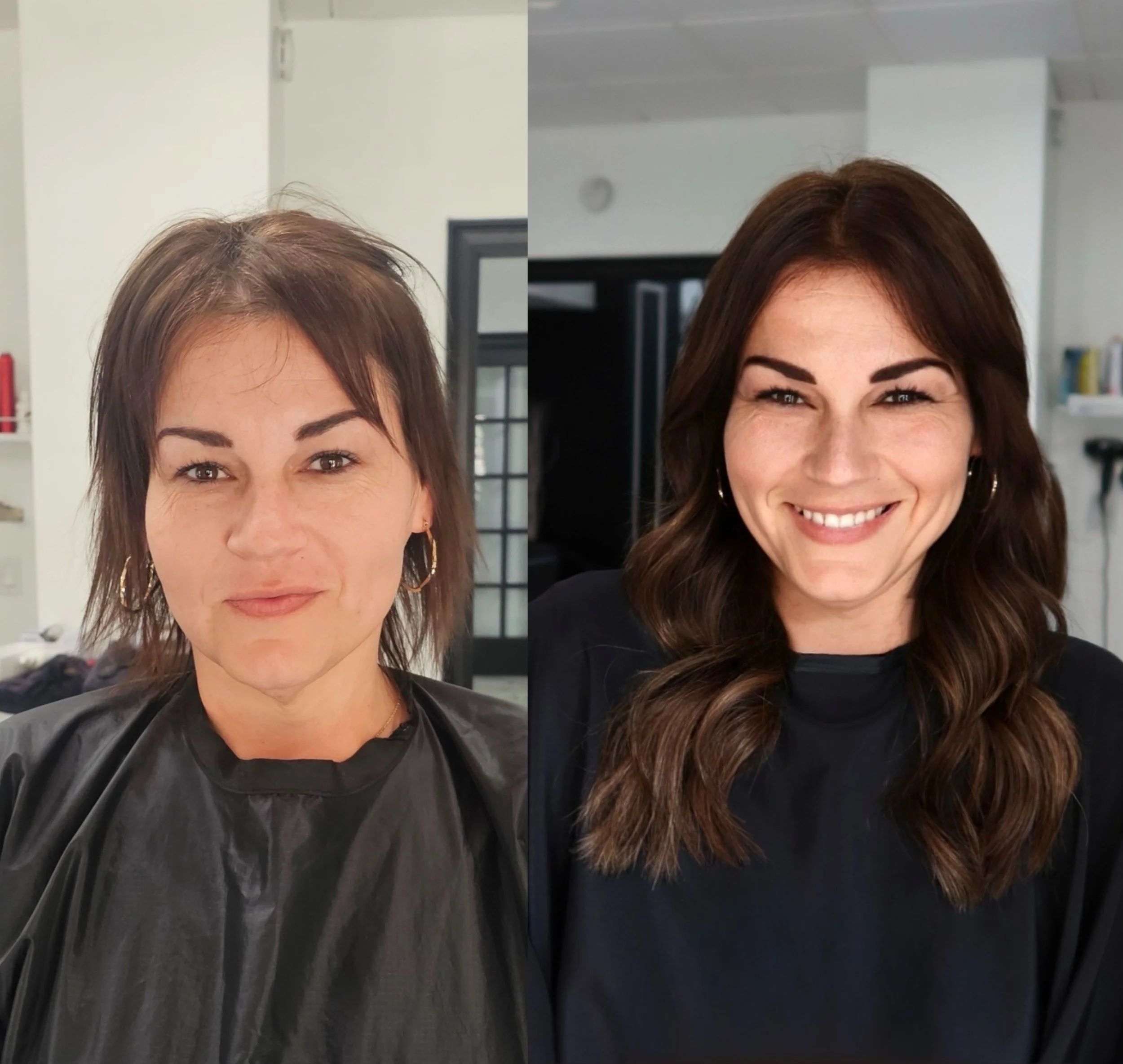 client with bariatric surgery and then trying glp1 lost all of her hair before and after side by side comparison