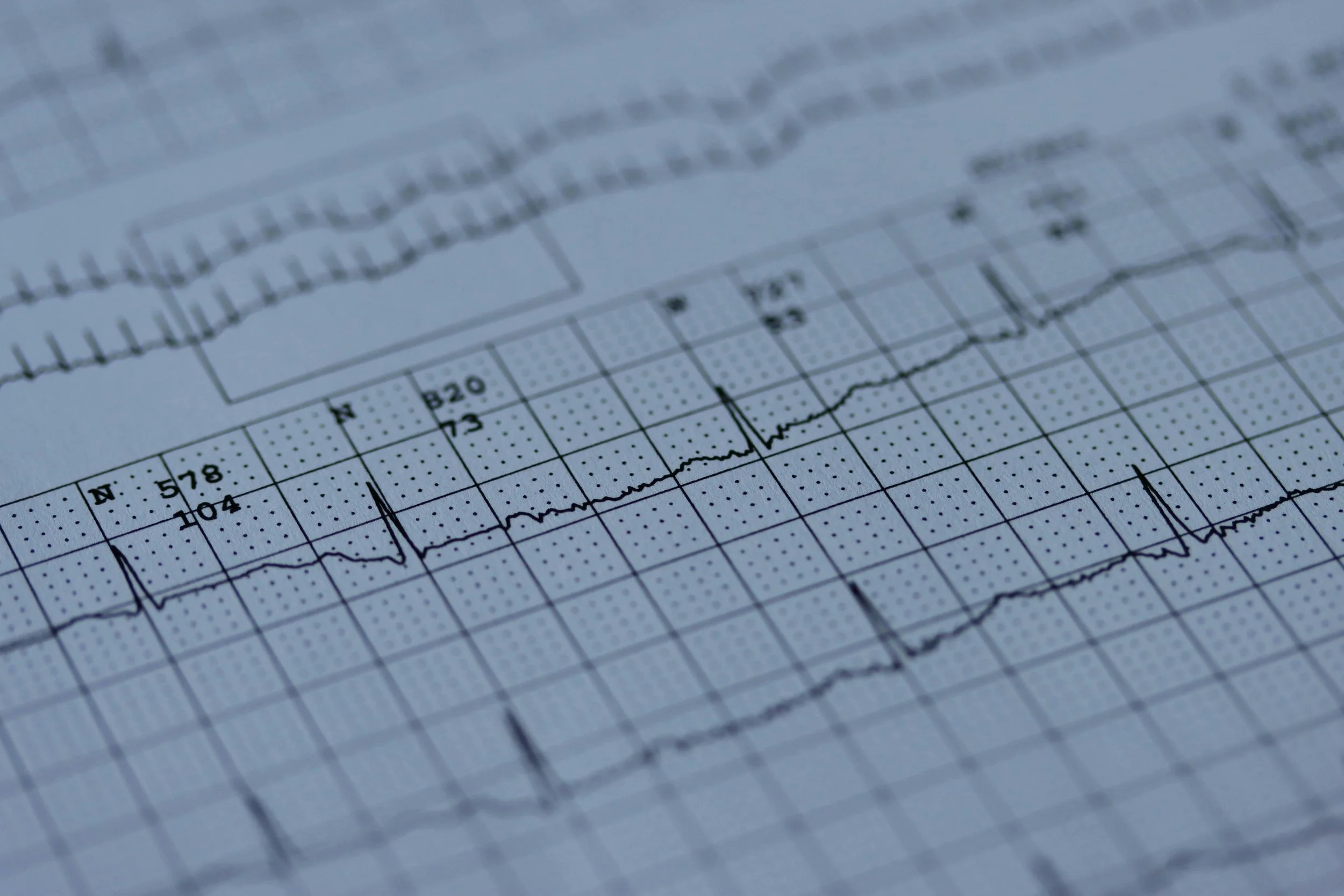 Let’s Make a DIY Seismograph