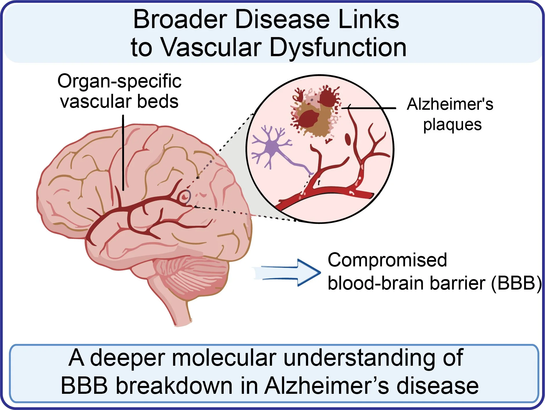 Diagram showing the connection between broader disease links to vascular dysfunction, specifically highlighting organ-specific vascular beds, Alzheimer's plaques, and compromised blood-brain barrier (BBB), with a caption about molecular understanding of BBB breakdown in Alzheimer's disease.