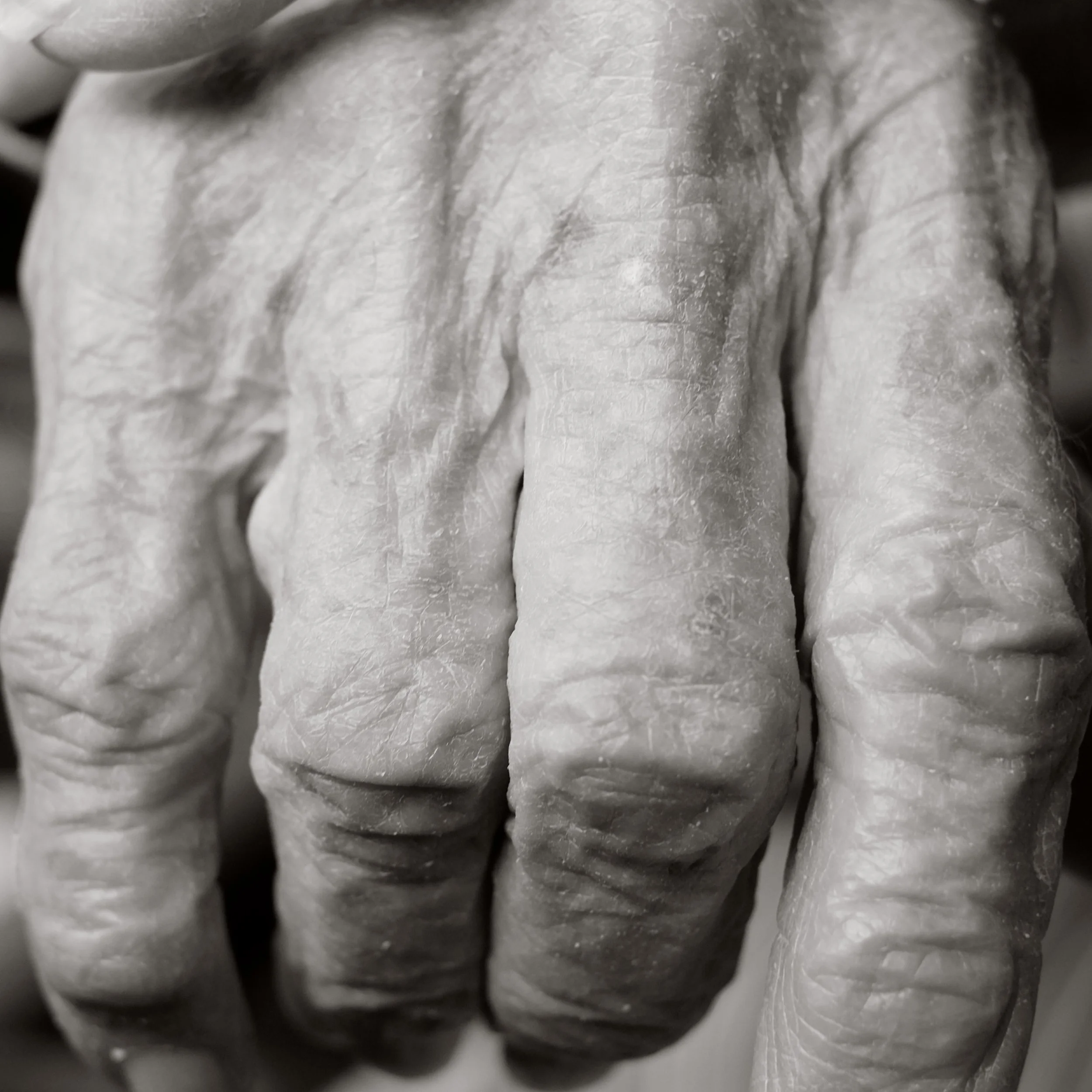 Close-up black and white photo of wrinkled, aged hand with prominent knuckles.