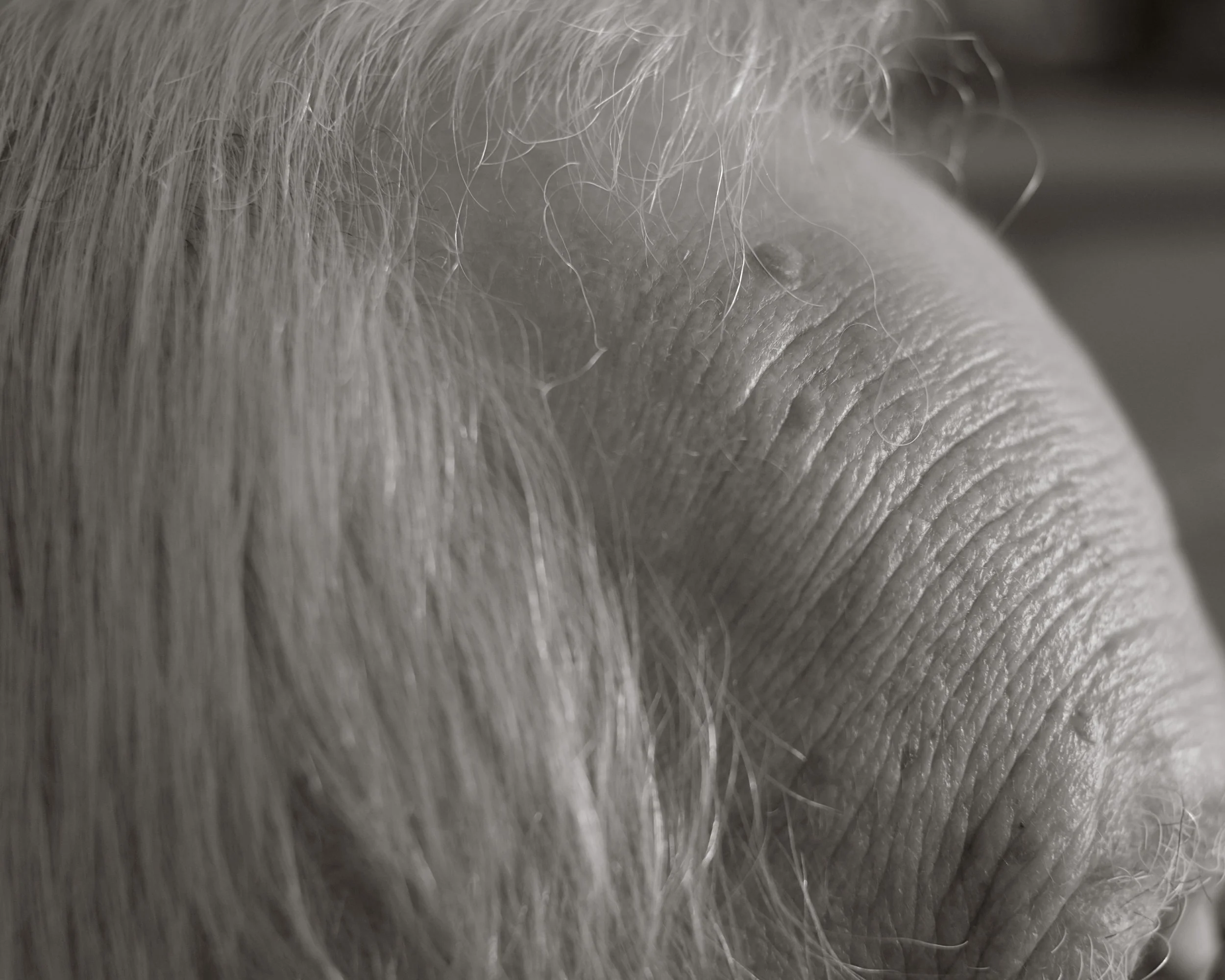 Close-up of an elderly person's forehead with visible wrinkles and light-colored hair.