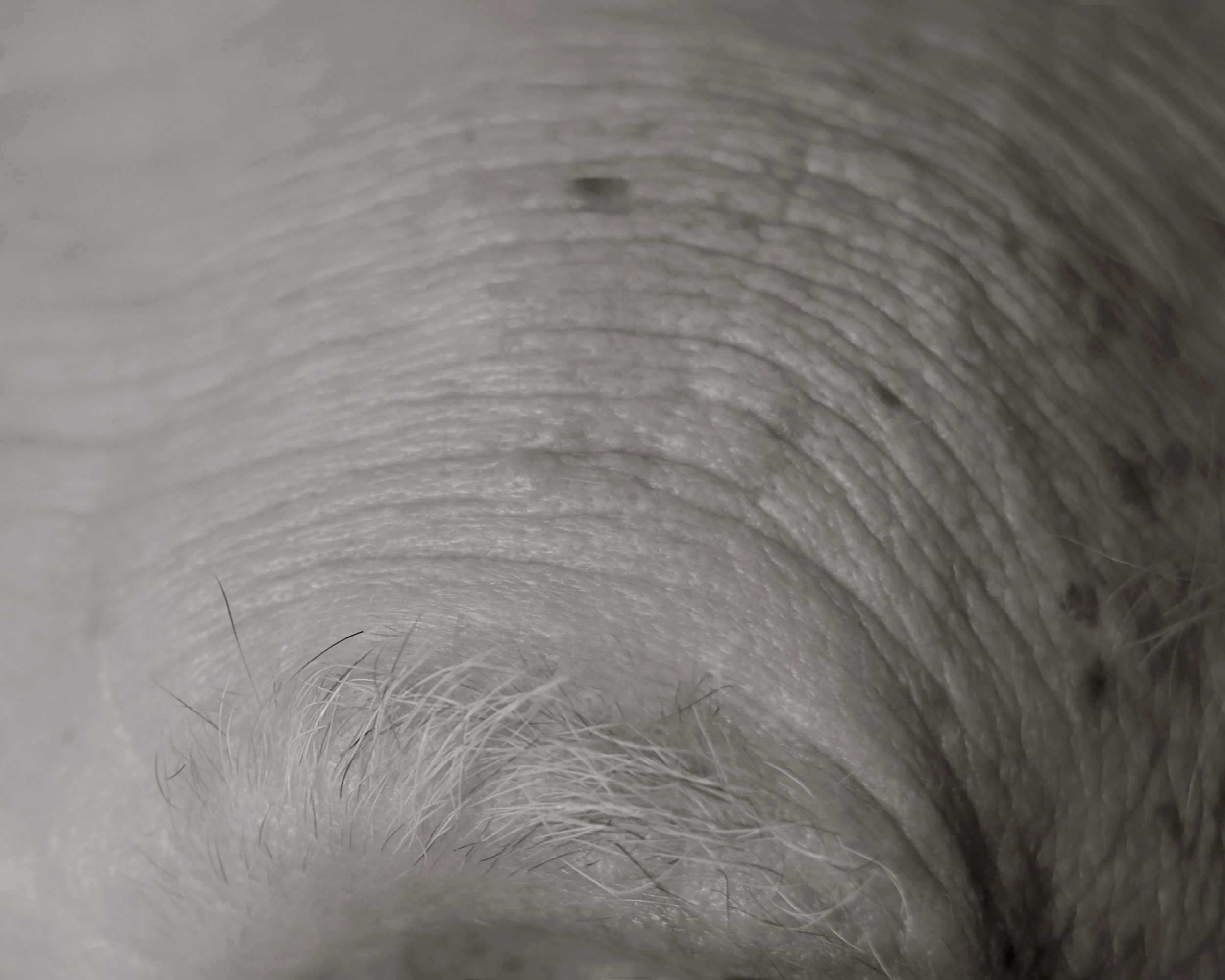 Close-up of a person's scalp and hair follicles in black and white.