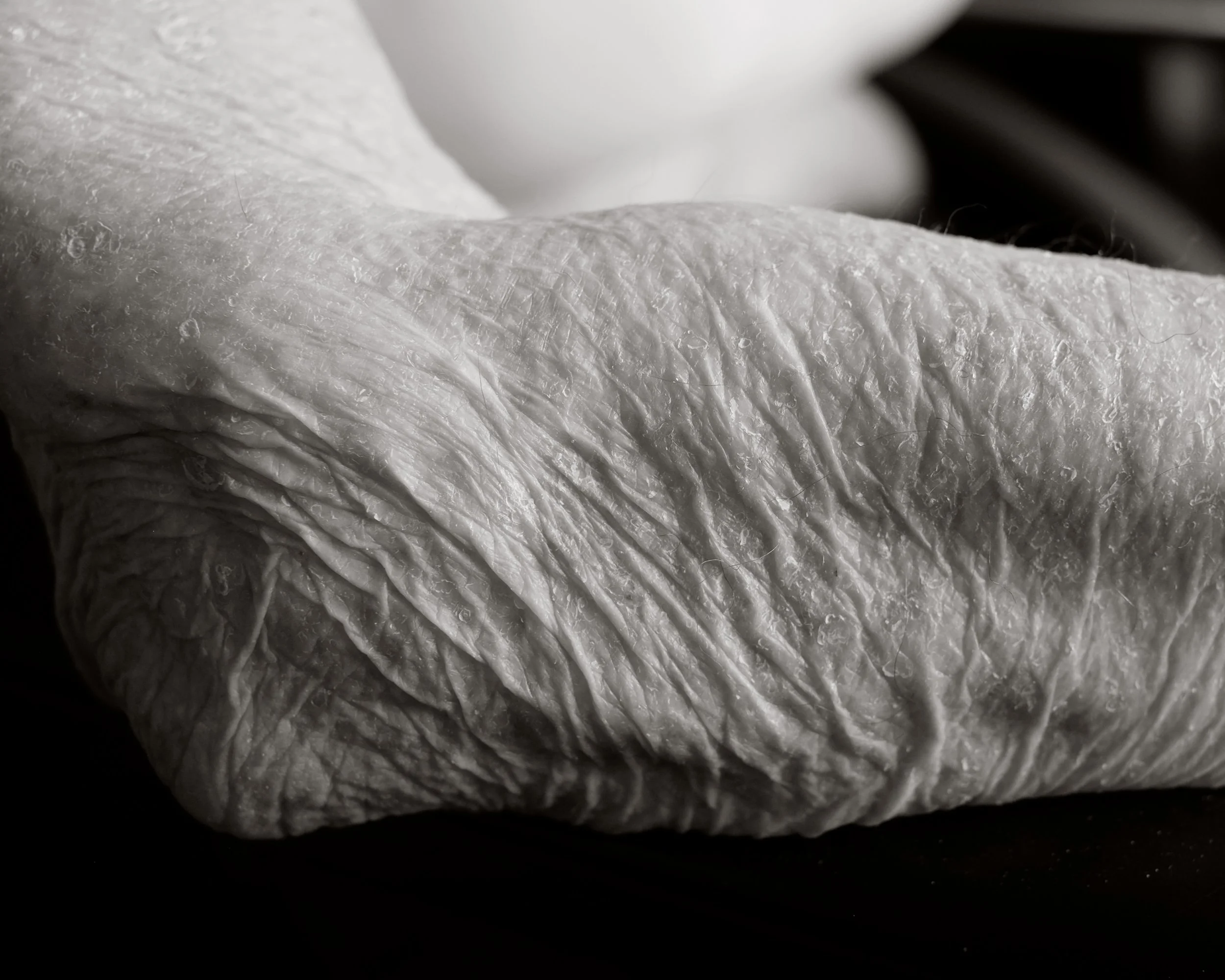 Close-up of wrinkled, textured skin, showing folds and creases of people over the age of 100