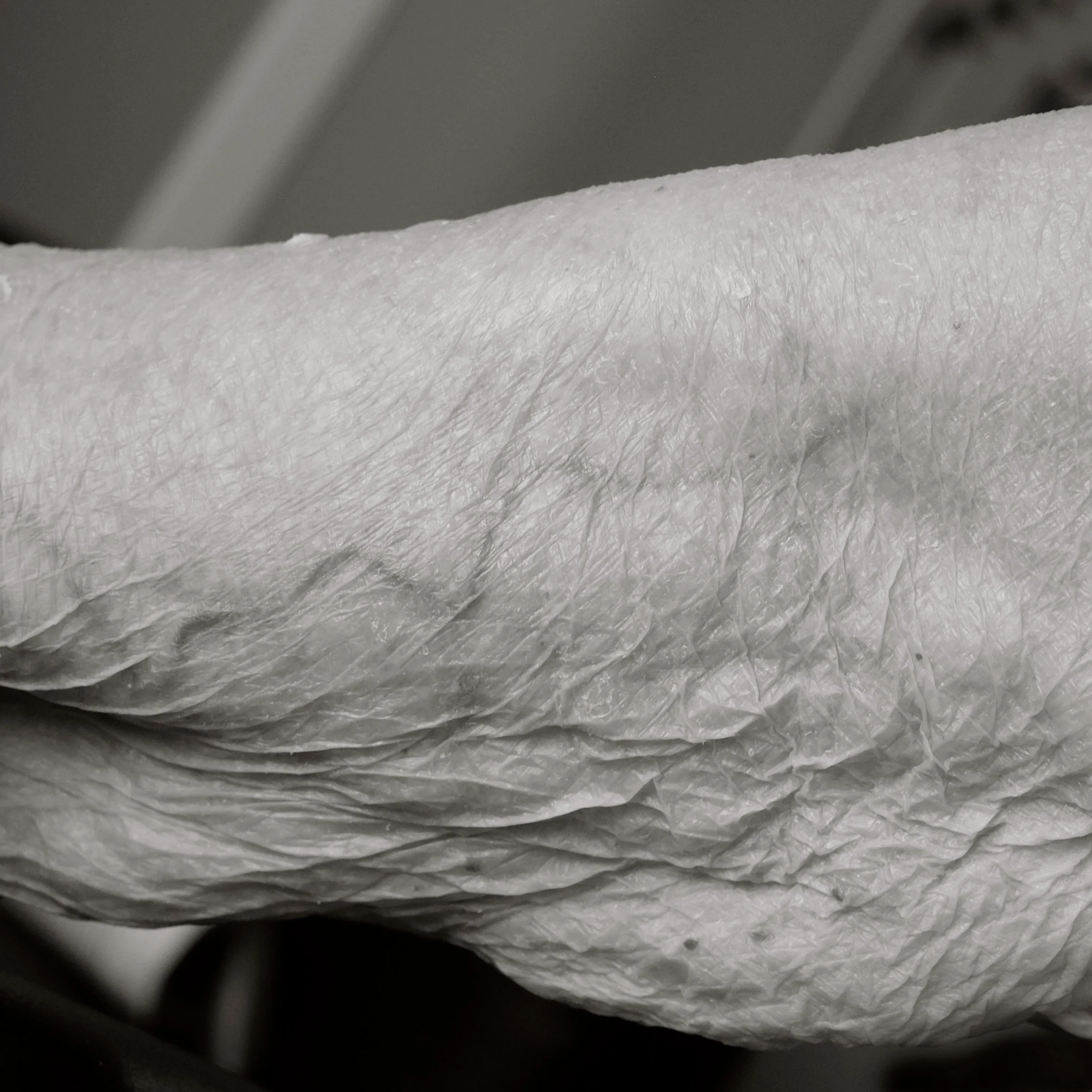 Close-up of a wrinkled, textured, light-colored skin surface, possibly a hand or foot.