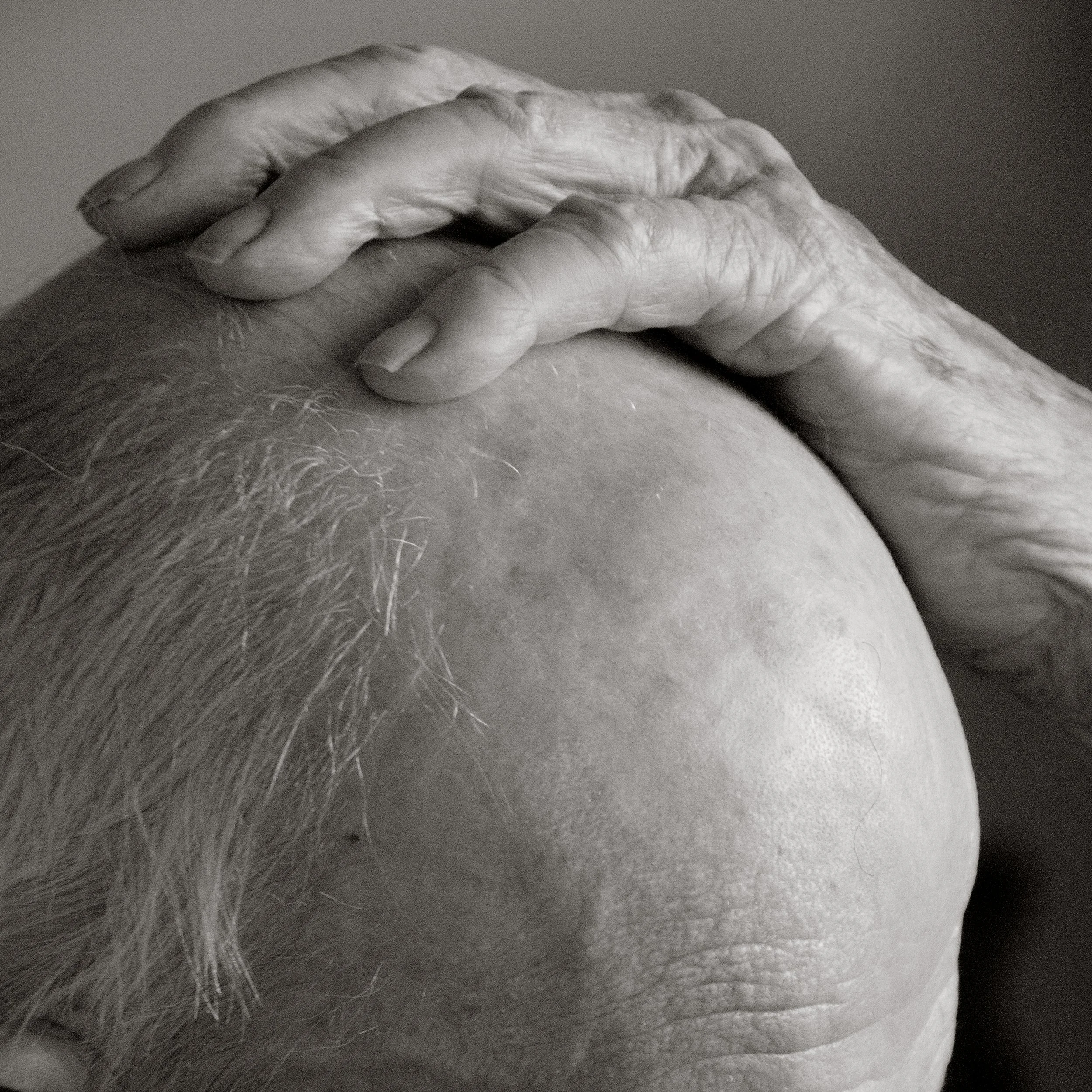 Close-up of an elderly person's head with thinning hair, showing a hand resting on top of the head. The image is in black and white.
