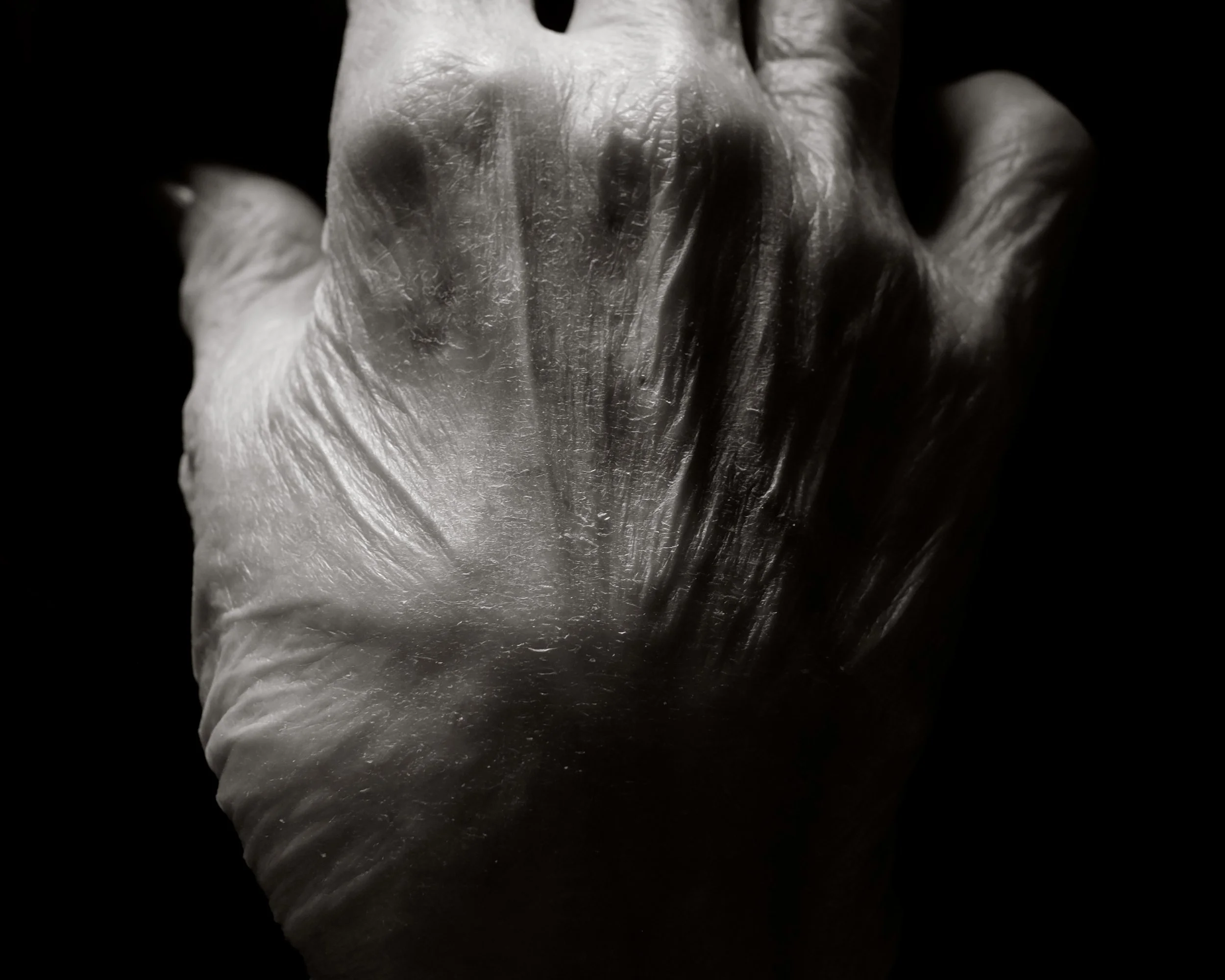 Close-up black and white photo of a human hand with detailed skin texture, viewed from the palm side.