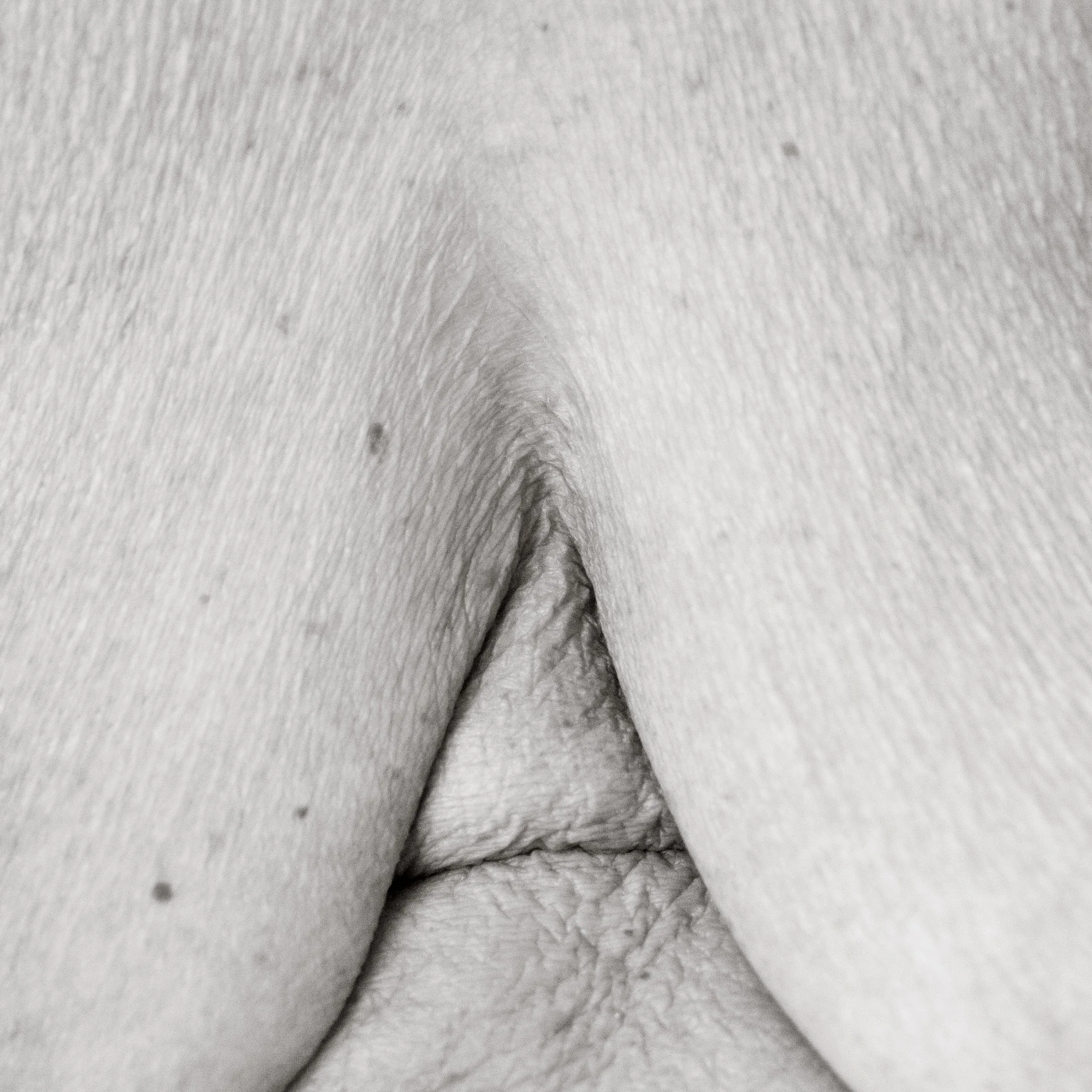 Close-up of human skin and part of the genital area in black and white.