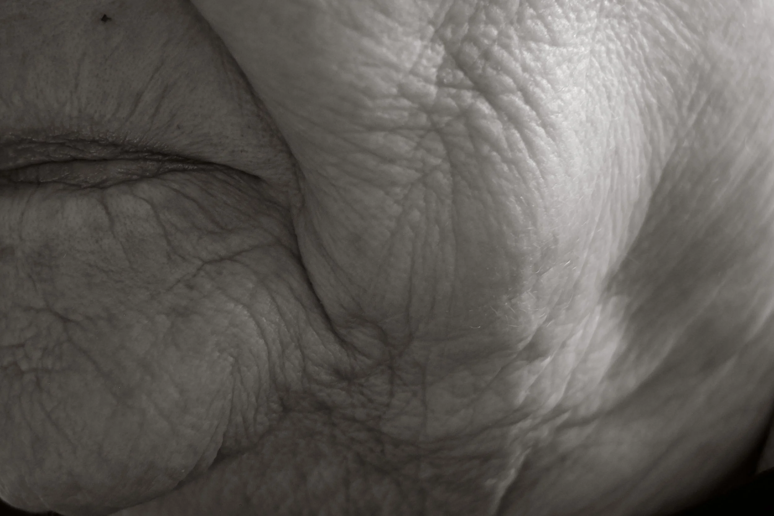 Close-up of textured, wrinkled, and light-colored human skin.