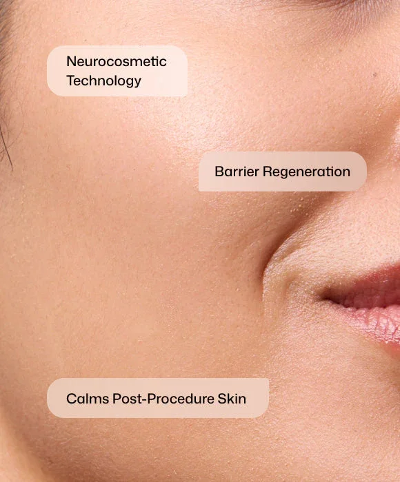 Meraki Revision cmt-post-procedure-cream Benefits.webp