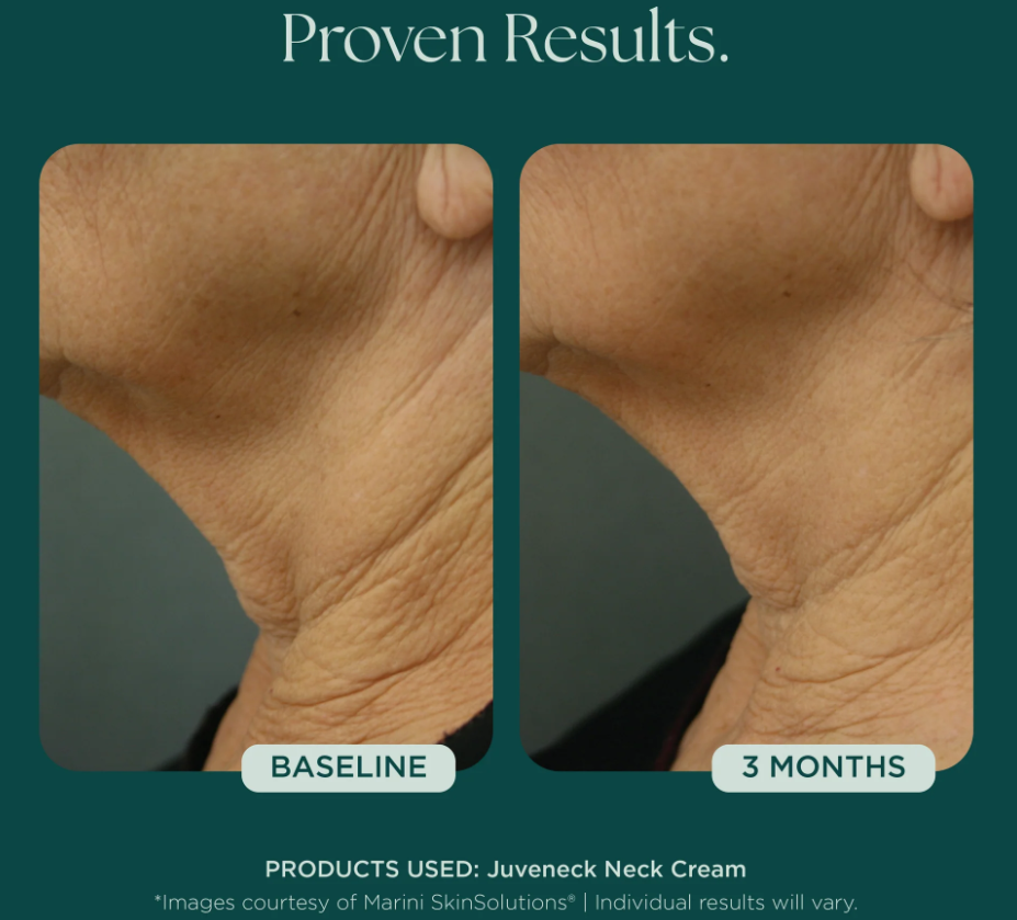 Meraki Marini Juvaneck Before_After_1.png