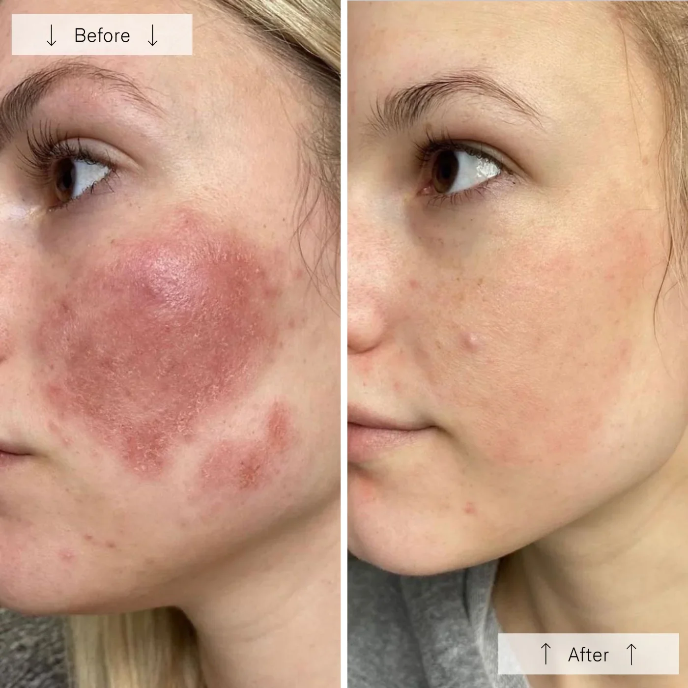 Meraki Omnilux Contour_Face_Cover_Image_8.webp