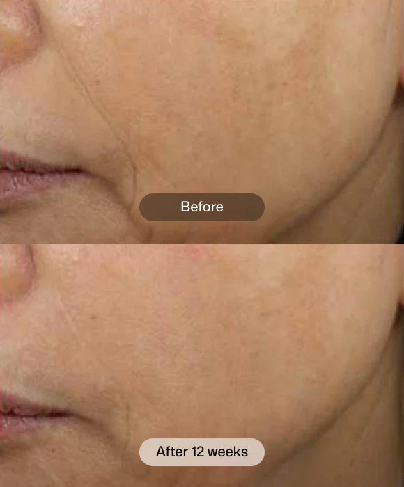 d-e-j-face-cream-Before and After.webp