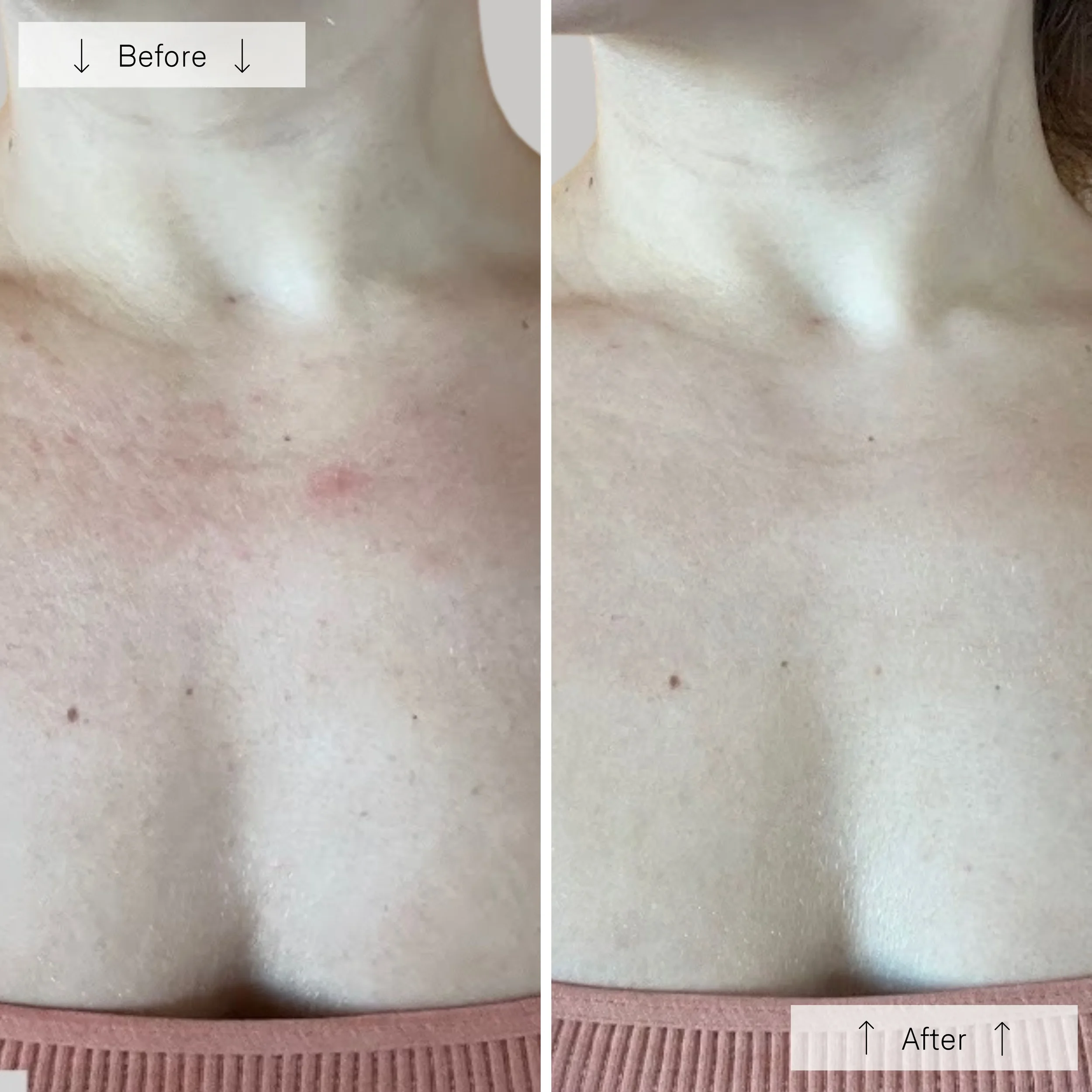 Meraki Omnilux Countour Neck Decollete_8.webp
