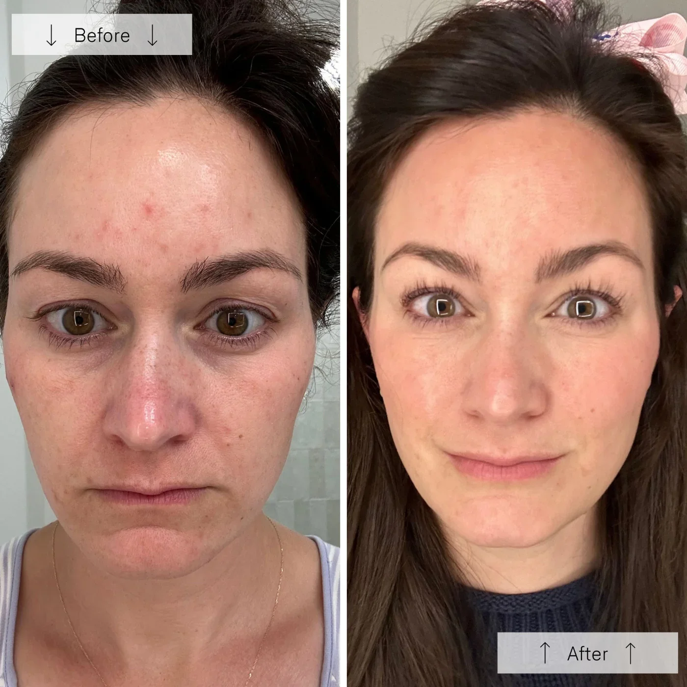 Meraki Omnilux Contour_Face_Cover_Image_6.webp